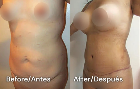 Cirujano plastico en tijuana