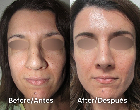 cirujano experto en cirugia de nariz en tijuana