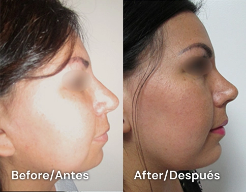 cirujano plastico certificado e san diego