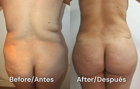 clinica de cirugía plastica en tijuana