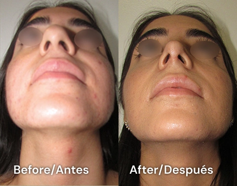 clinica de cirugia plastica san diego tijuana