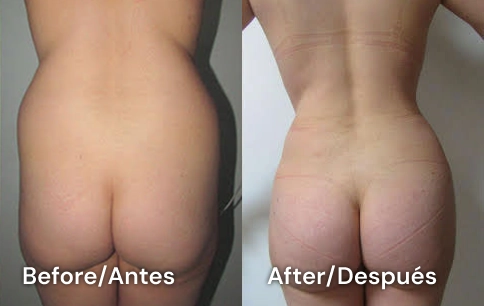 plastic sourgeon tijuana